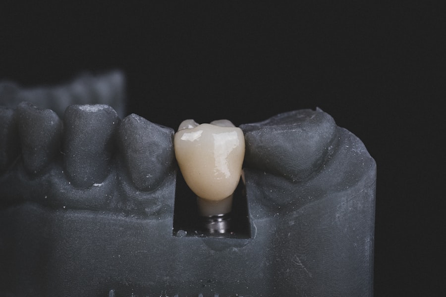 Photo Tooth falling