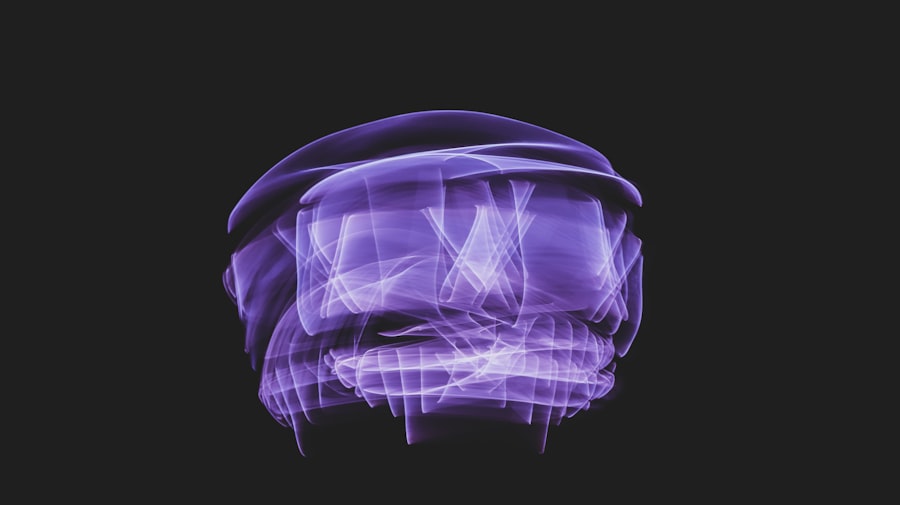 Photo Brain activity